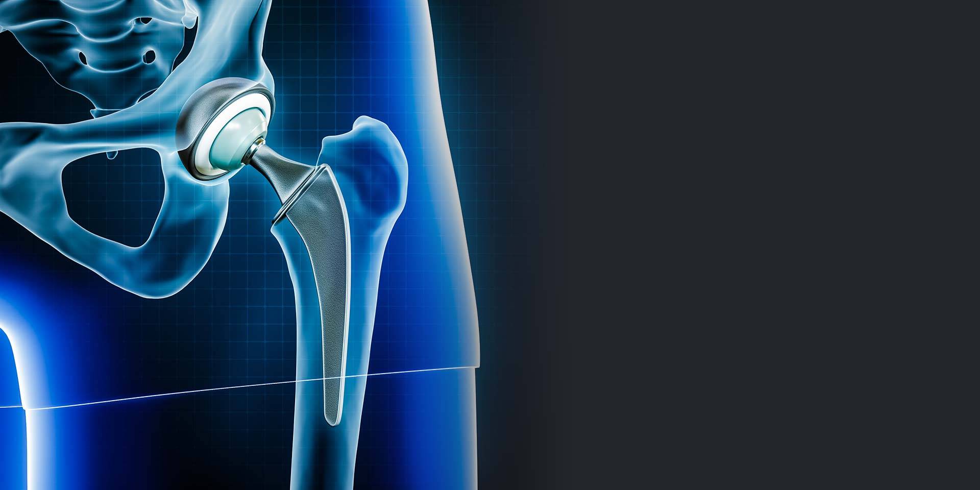 alderfer-bergen-co-orthopedics